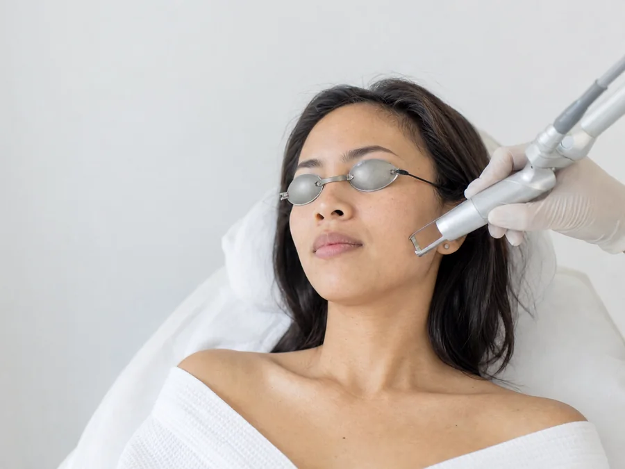 A woman having a laser treatment on her cheek, wearing protective eye shields